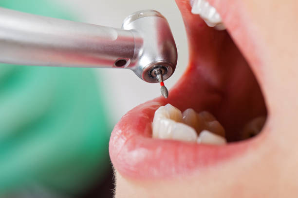 Best Broken or Cracked Tooth Emergency Dentist in Mineral Springs, AR
